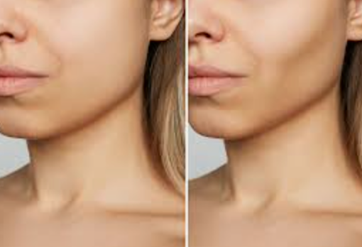 Veranderingen in je gezicht bij gewichtsverlies: wat is er waar van “Ozempic face”?